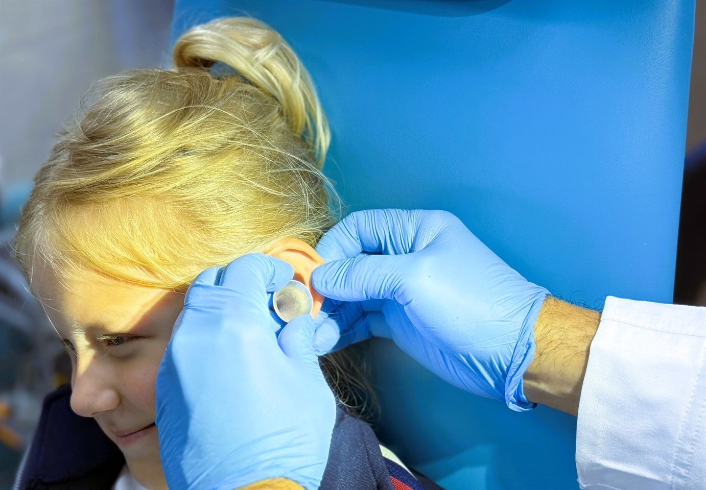 Хронический средний отит (ХСО)