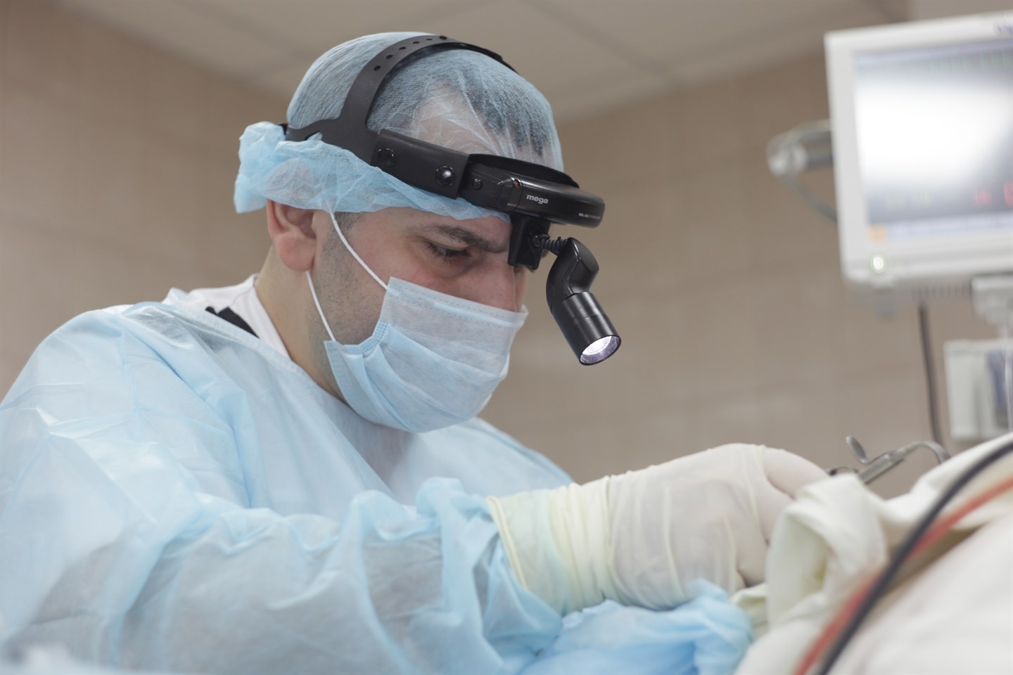 Удаление миндалин