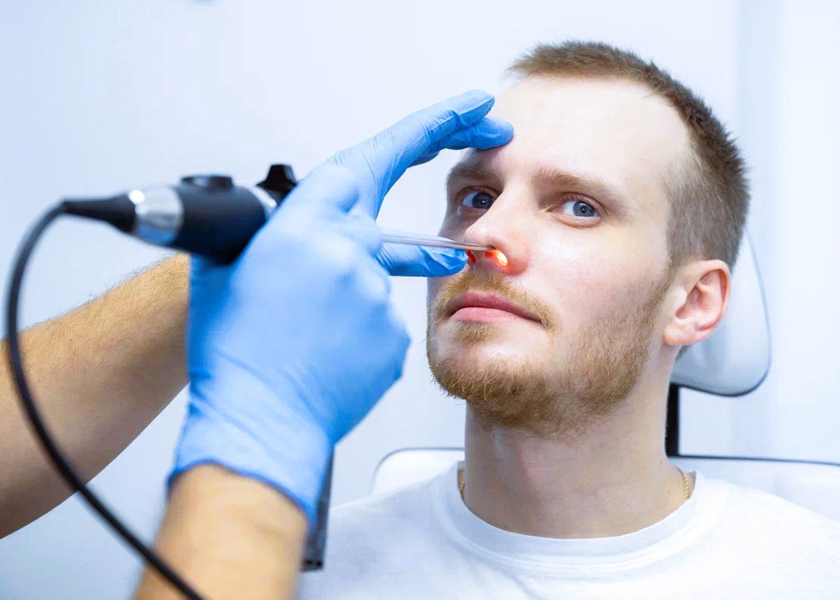 Эндоскопия носа ригидным эндоскопом 