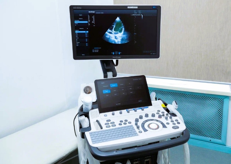 Ультразвуковое исследование (УЗИ)