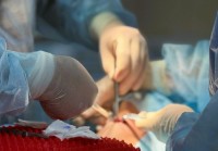 Тиреопластика