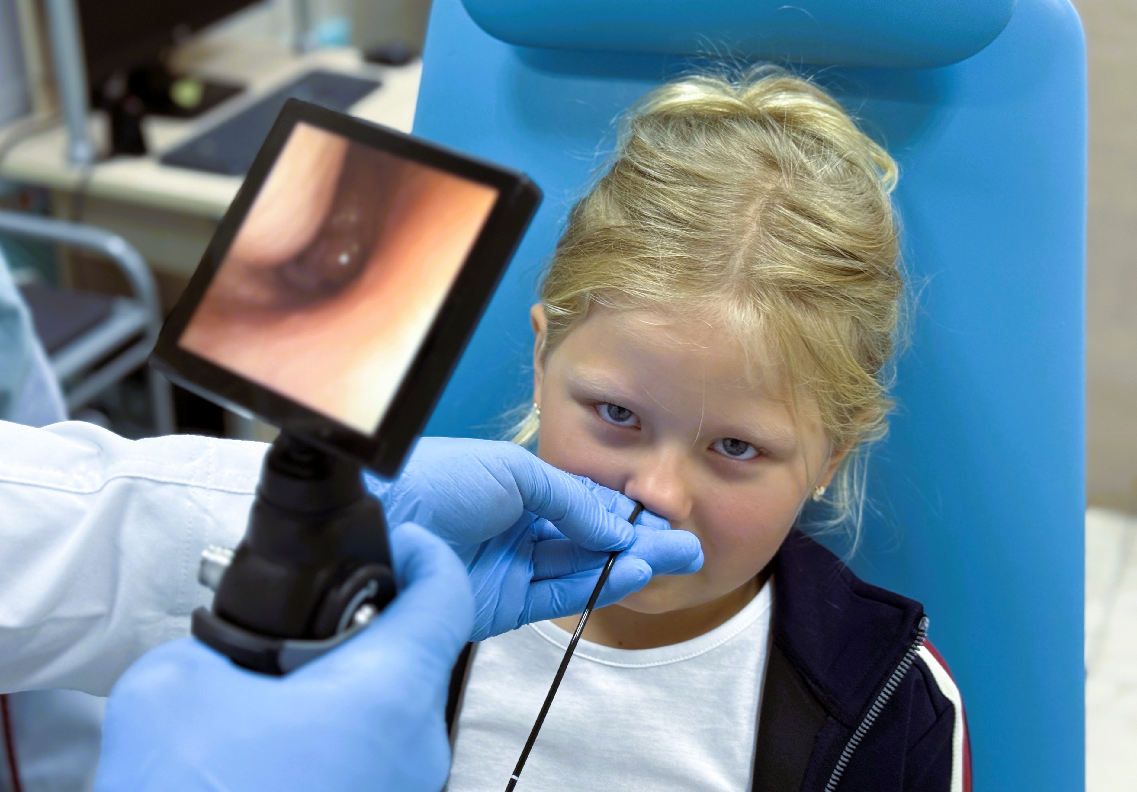 Эндоскопическое обследование носа у детей при помощи гибкого эндоскопа