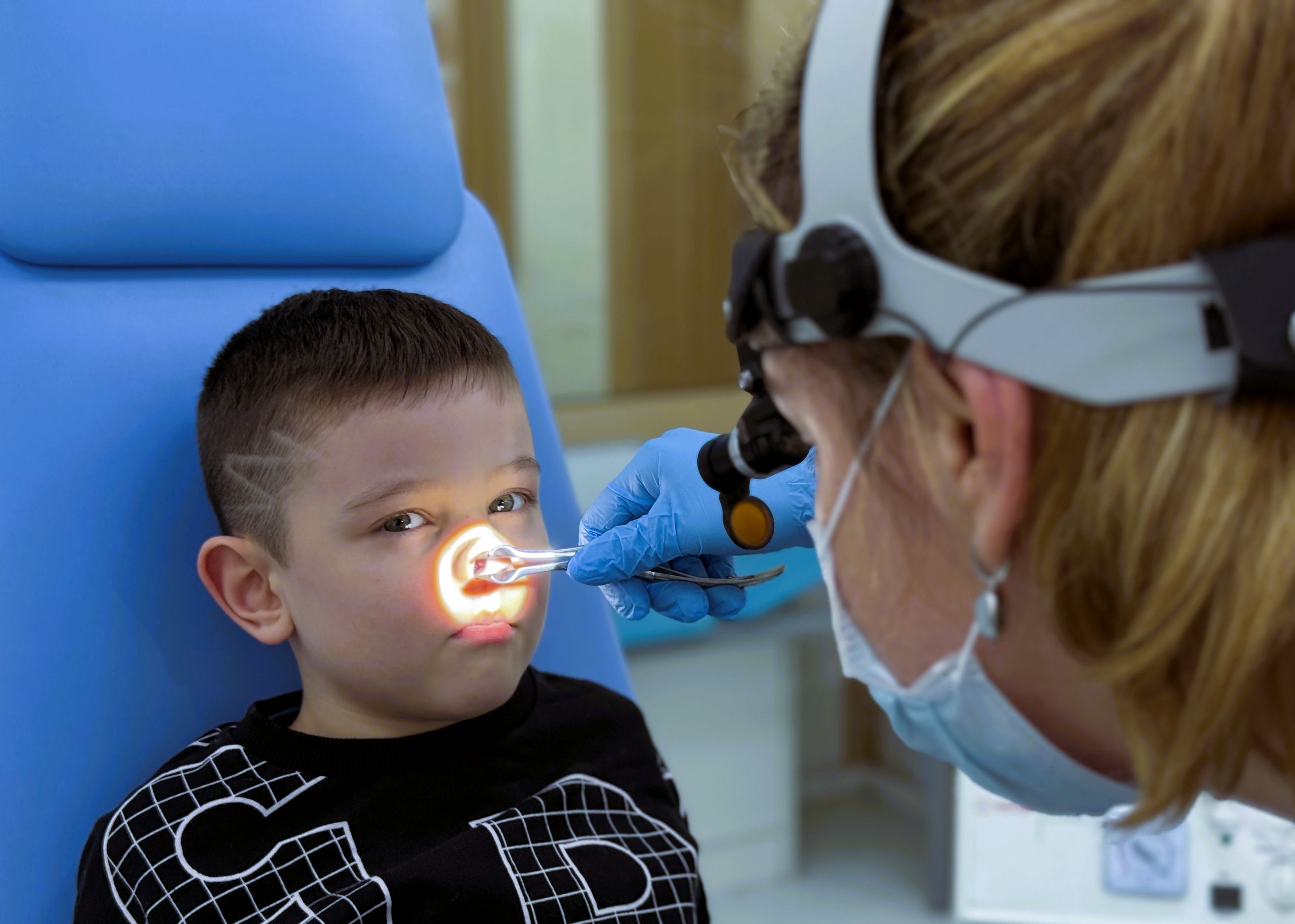 Удаление инородных тел из носа 