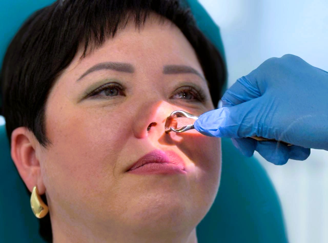 Тампонада носа 