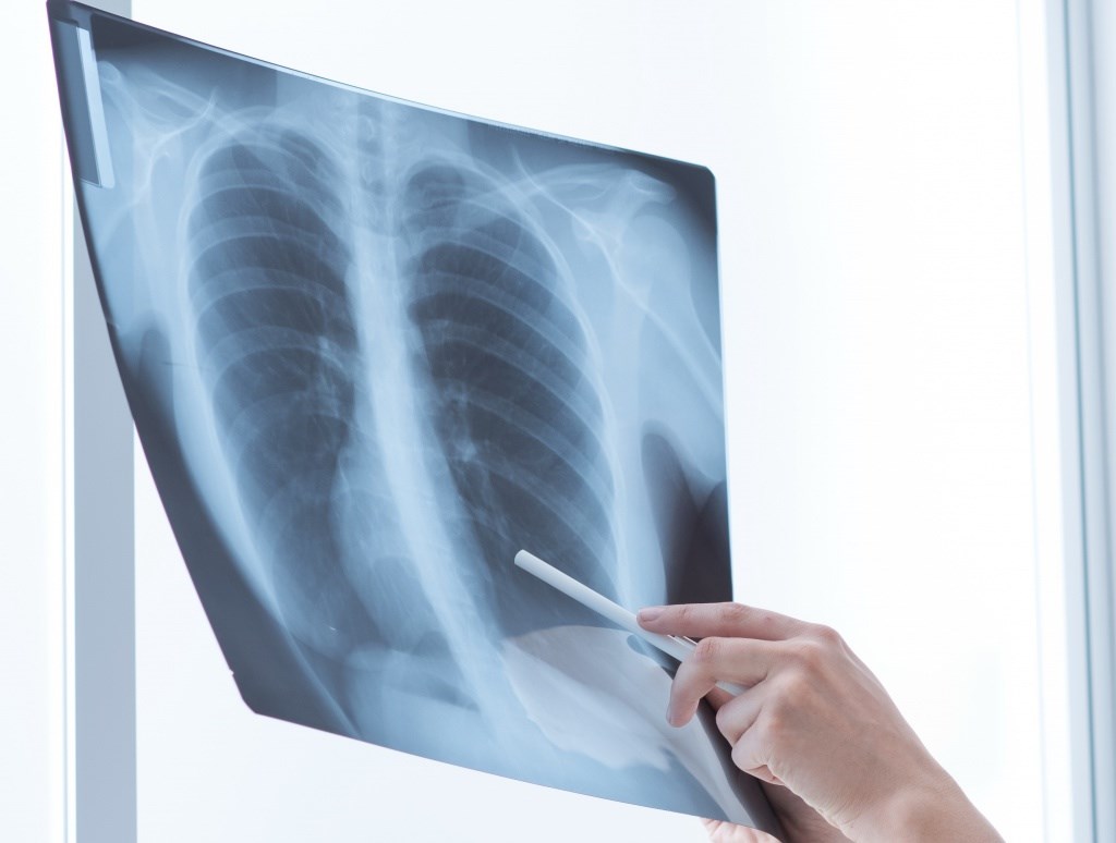 Надо ли мне к пульмонологу?