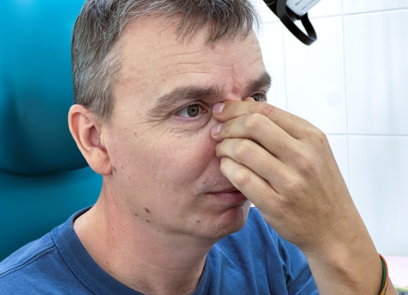 Деформация наружного носа. Искривление перегородки носа. Хронический вазомоторный ринит. Киста правой верхнечелюстной пазухи