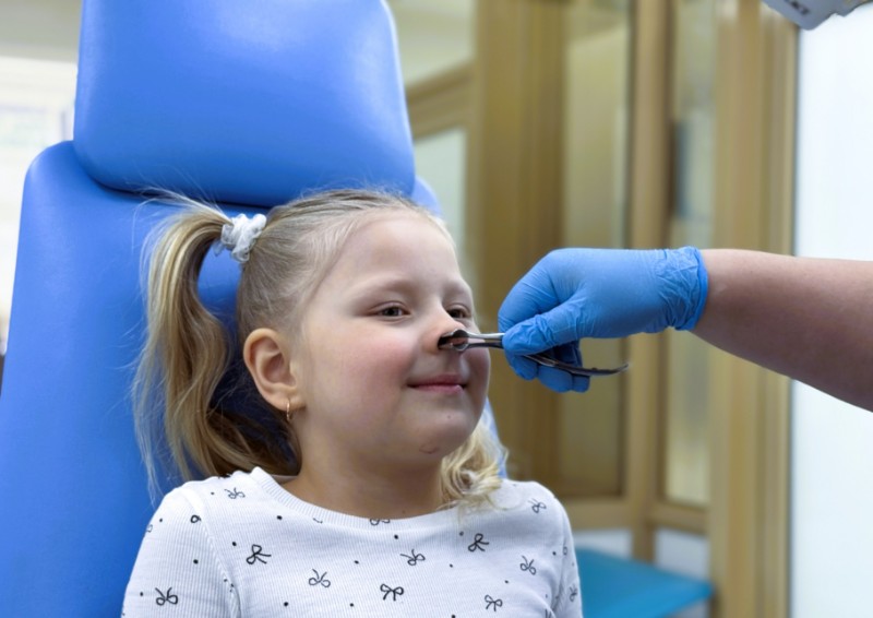 Синдром Маршалла, миндалины 3 степени у девочки 5 лет
