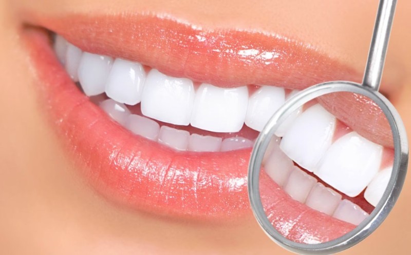 Акции - Белоснежная улыбка со скидкой 3500₽ и 6000₽!