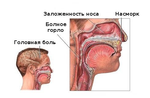 лечение ринита